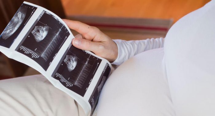 El desconocido impacto del embarazo en el lipedema: enfermedad crónica afecta a miles de mujeres