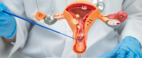 Papanicolau: ¿Por qué las mujeres no se realizan este examen para prevenir el cáncer?