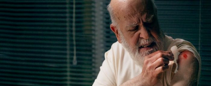 Lesiones por adhesivos médicos en UCI: alerta sobre riesgos para la piel y seguridad del paciente