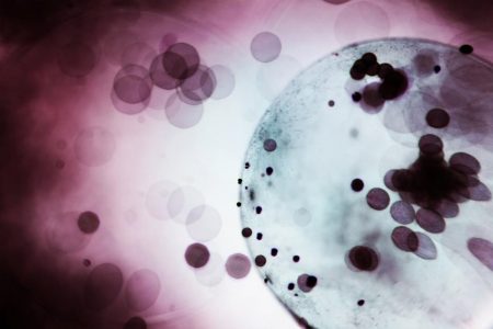 Investigadores chilenos descubren cómo el lupus afecta la memoria y provoca disfunción cognitiva