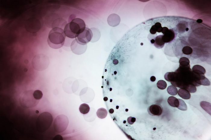 Investigadores chilenos descubren cómo el lupus afecta la memoria y provoca disfunción cognitiva