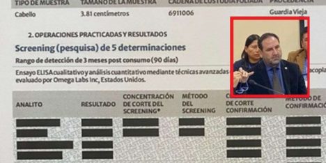 Subsecretaría de Agricultura se niega a revelar las drogas pesquisadas en test a exseremi