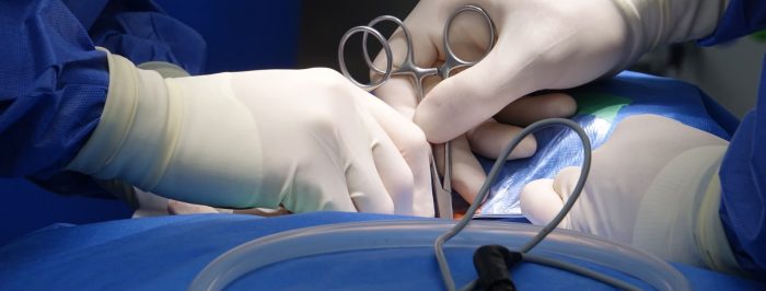 Reconstrucción abdominal tras bajar de peso: aumenta la abdominoplastia con Bono PAD de Fonasa