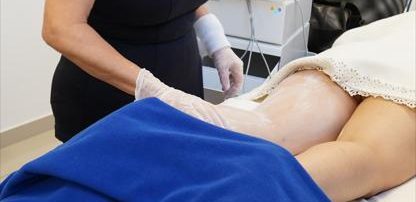 Lipedema: especialistas entregan claves para disfrutar el invierno sin aumentar la inflamación
