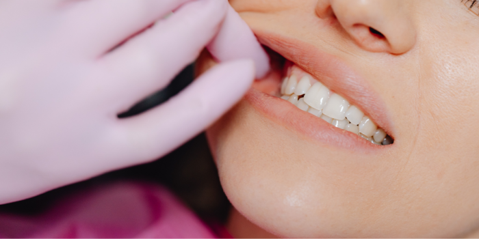 Mal aliento y sangrado de encías: señales que podrían alertar de periodontitis