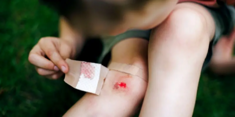 Mercurocromo: el antiséptico que curó las heridas de millones de niños y terminó prohibido