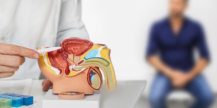 Los hombres que más consumen ultraprocesados tienen hasta 30% más riesgo de cáncer de próstata