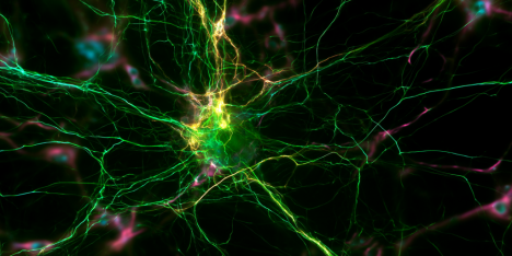 La fiesta del cerebro a la que todos estamos invitados