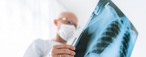 Qué debemos saber sobre la tuberculosis