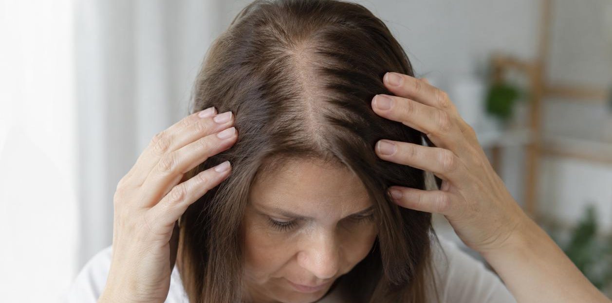 Caída del cabello en la menopausia: por qué no siempre es inevitable y cuándo acudir al especialista