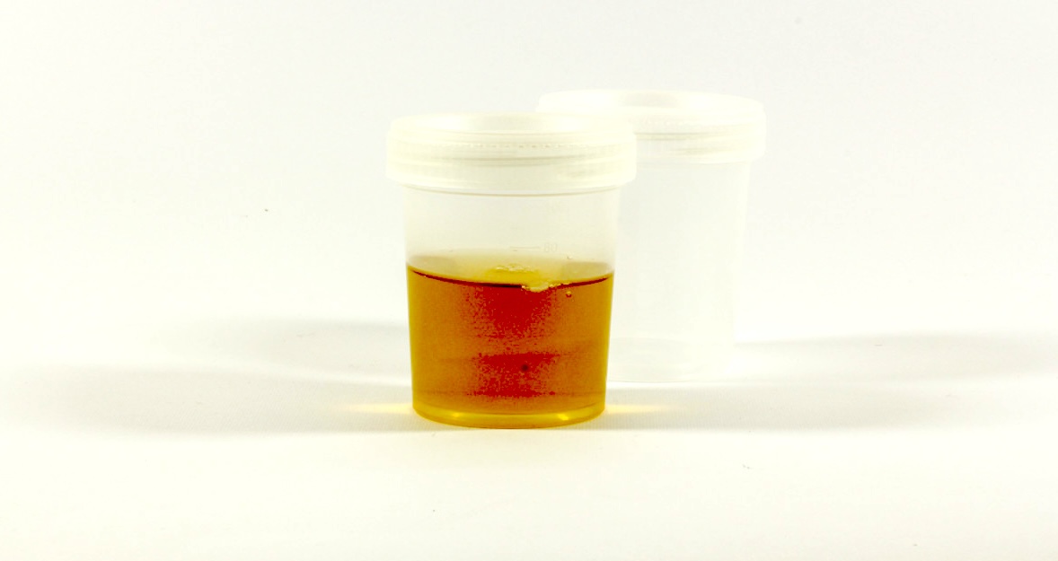 ghk cu peptide hair growth evidence study ghk-cu clinical trial trials studies GHK- Benefits (And a Few Risks) Explained Koppā Beauty ghk-cu copper peptide hair growth – GHK-Cu Dosage and Protocol: The – Packaging Option:Single Pack 1500mg Glutathione The surgical challenges of