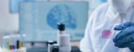 Un hallazgo chileno abre nuevas pistas sobre el origen temprano de la esquizofrenia
