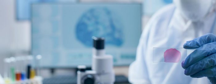 Un hallazgo chileno abre nuevas pistas sobre el origen temprano de la esquizofrenia
