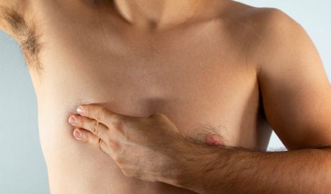 Cáncer de mama en hombres: una enfermedad poco frecuente que suele detectarse tarde