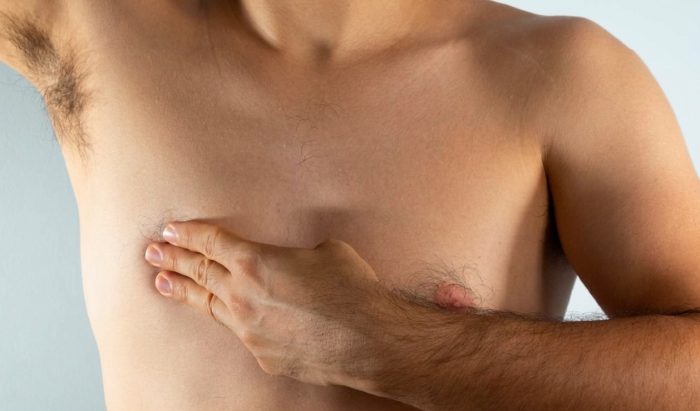 Cáncer de mama en hombres: una enfermedad poco frecuente que suele detectarse tarde