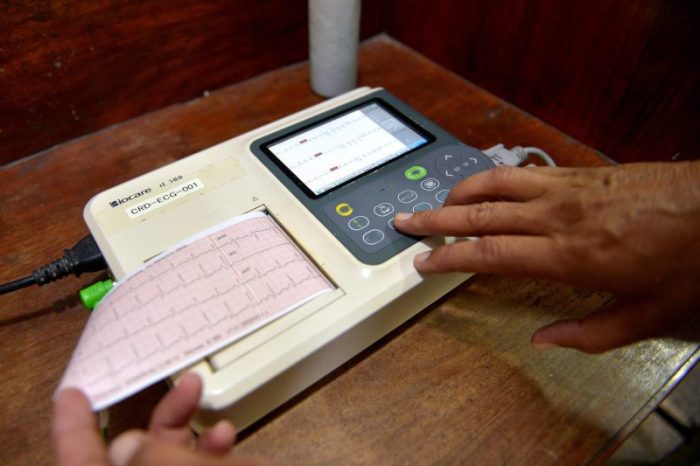 Especialistas alertan del aumento del riesgo cardiovascular en las mujeres durante la menopausia
